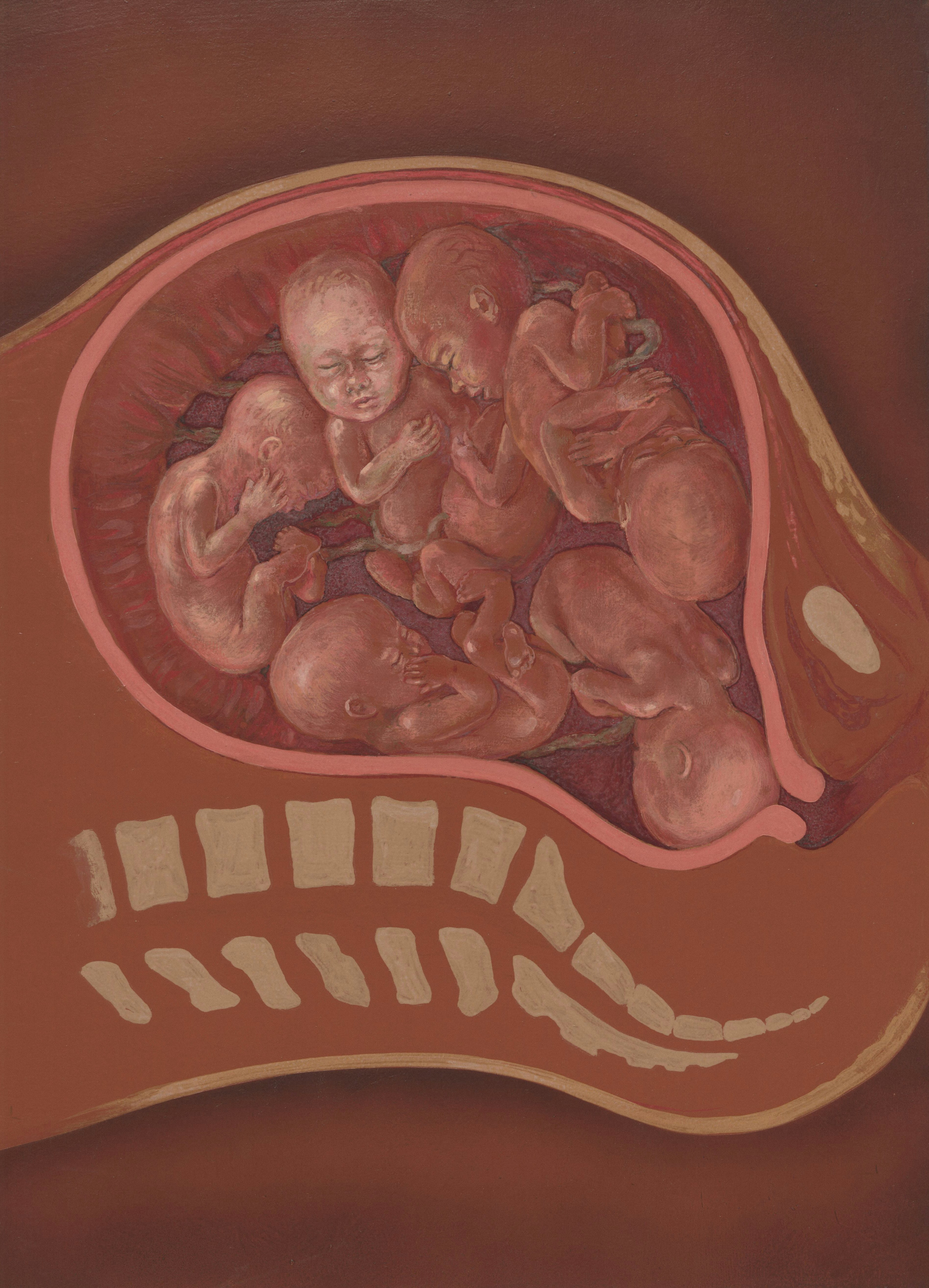 Medicina fetal e acompanhamento da gestação